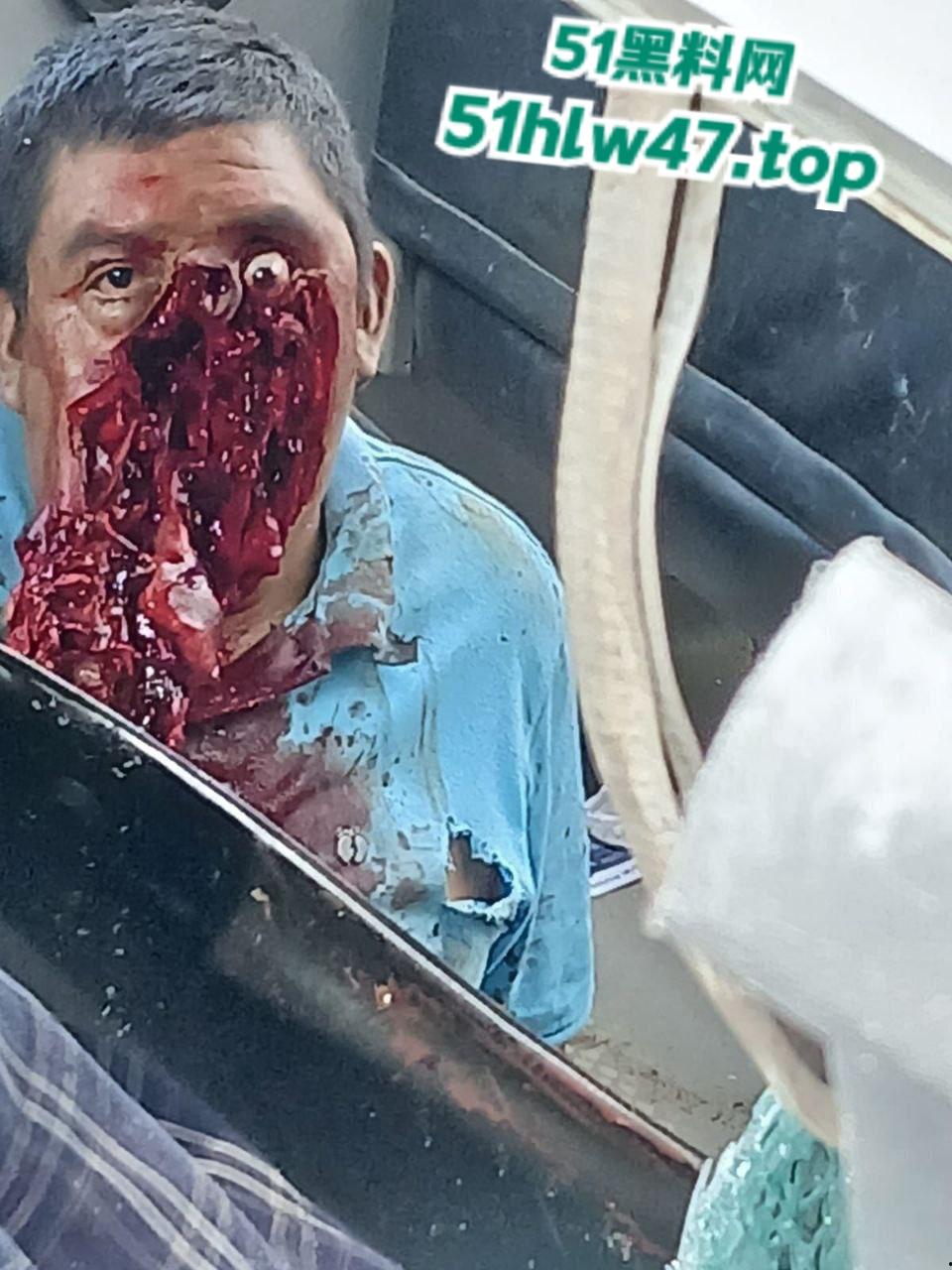 【血腥恐怖】印尼发生惨烈车祸，超速行驶失控后撞上前方货车，导致多人死亡司机直接面目全非。-4