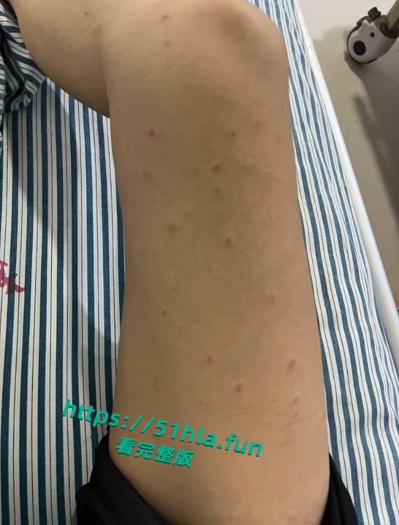 抖音女网红【轮滑冰姑娘】生化母体携带艾滋感染上千人人设翻车,遭网友质疑健康状况引发争议!-16