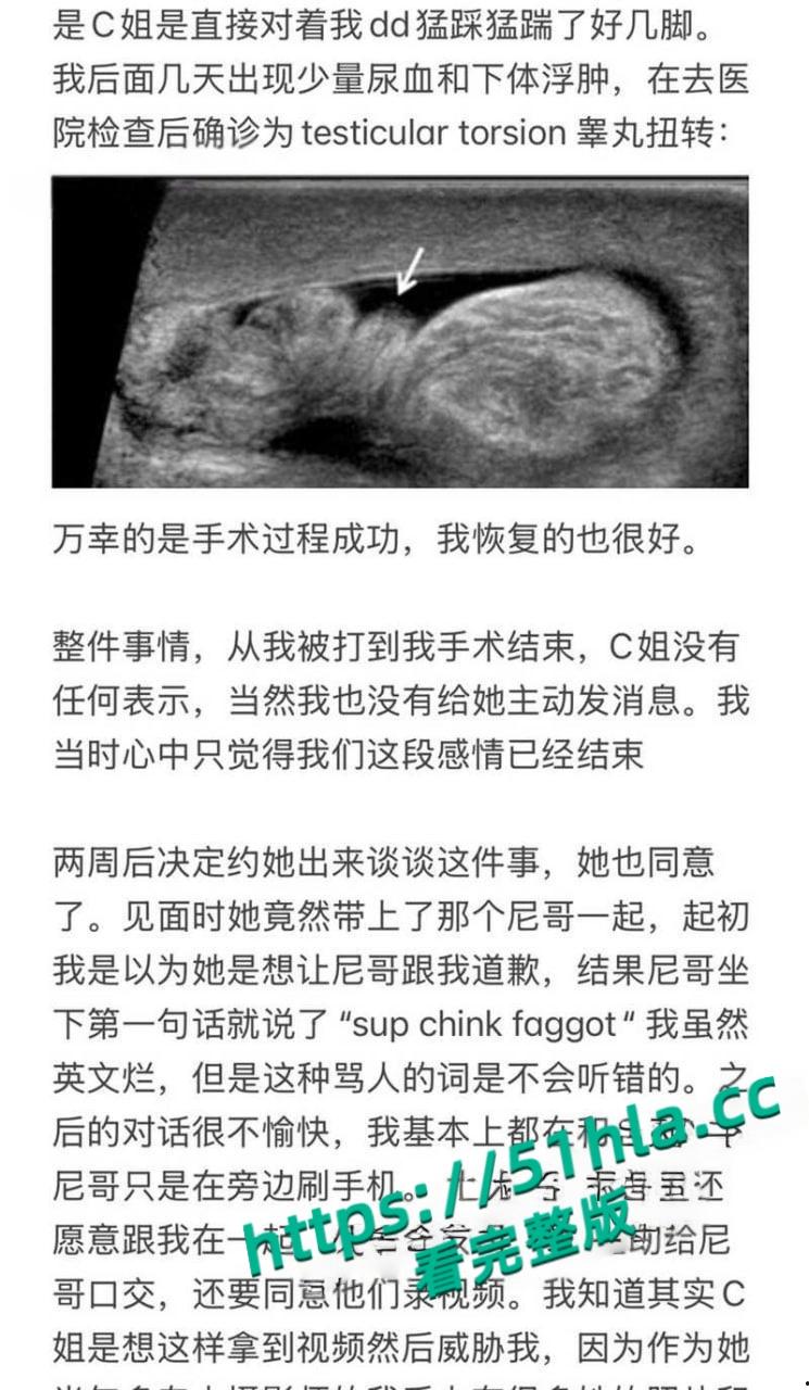 北美名校顶级媚黒骚逼【Caroline】淫乱大瓜,勾搭巨屌黑人3P逼绿帽男友吞精踢爆睾丸,野战后入偷拍视频曝光!-9