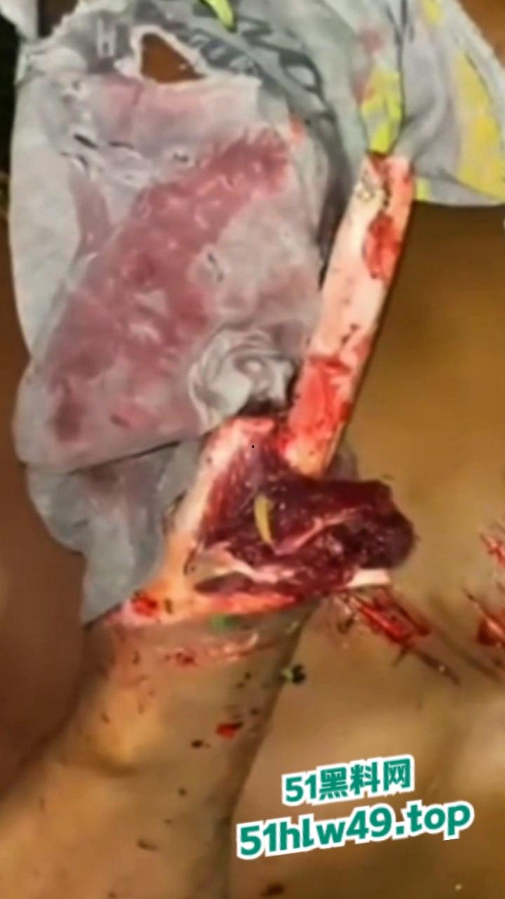 血腥恐怖,非洲南部车祸乡间公路步行,司机未看清路况当场将撞飞路人,手脚全断死相极其残忍。-5