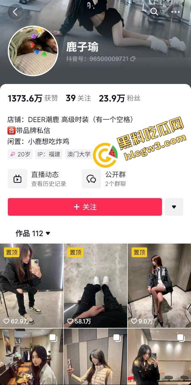 抖音极品美腿反差骚鸡服装网红『鹿子瑜』私下与金主激情 大长腿被抬起猛插粉嫩骚逼!独家曝光!-1