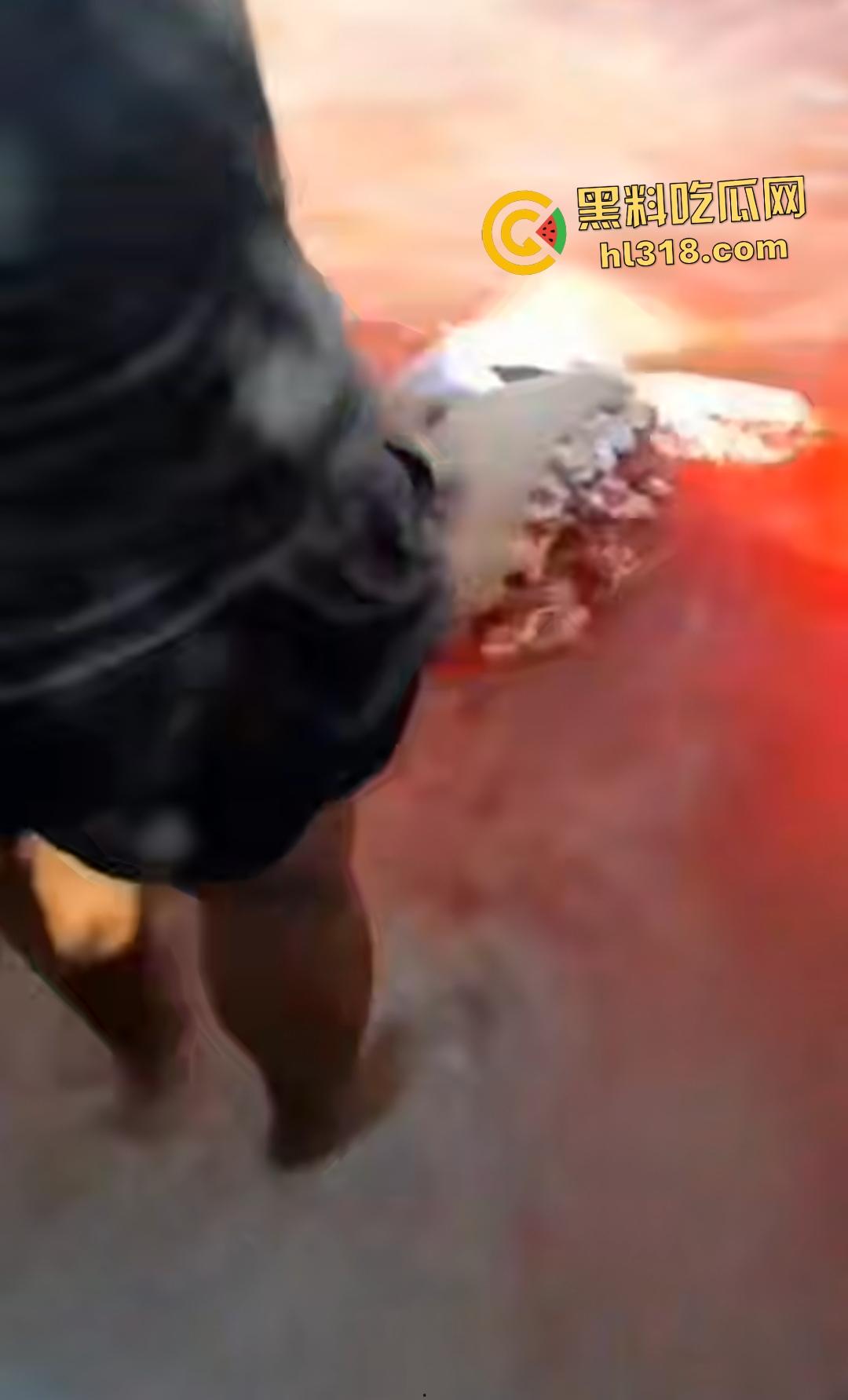黑人男子海边遭螺旋桨血腥绞杀！下半身肉烂血染红海，旁人妄图复原断肢，谁知身体差点变两半！-5