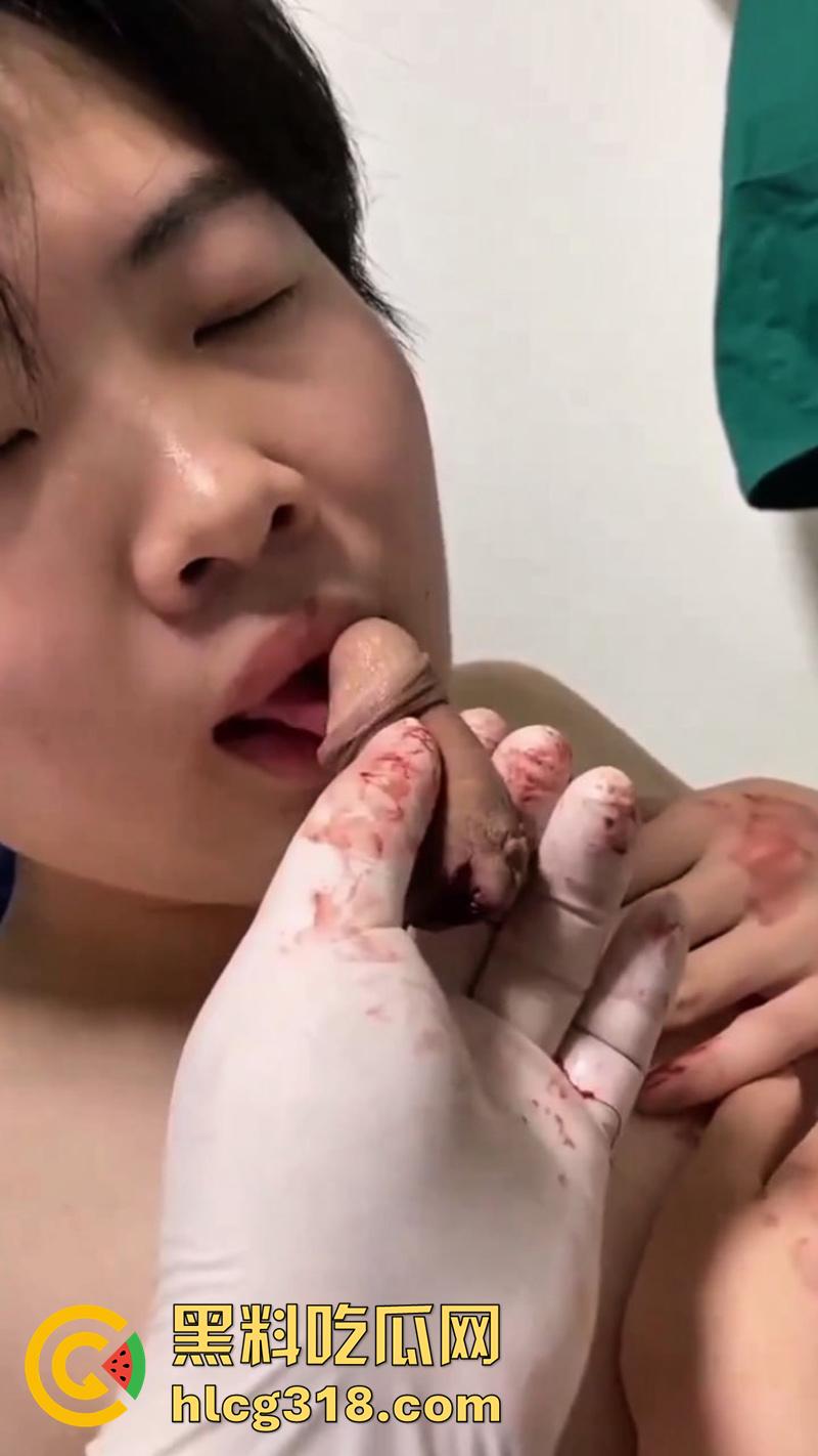 广西猛男刀切小鸡鸡,00后小火竟自己动手割下鸡巴,还给女友口交玩弄,现在都玩这么变态了么!-5