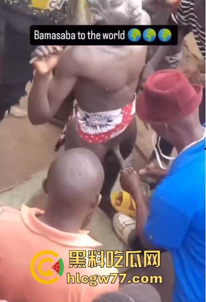 非洲部落割包皮 这也太生猛了吧 包皮一拉一刀下去直接割掉 这老哥全程面无表情！-2