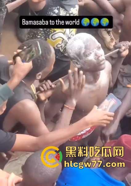 非洲部落割包皮 这也太生猛了吧 包皮一拉一刀下去直接割掉 这老哥全程面无表情！-4