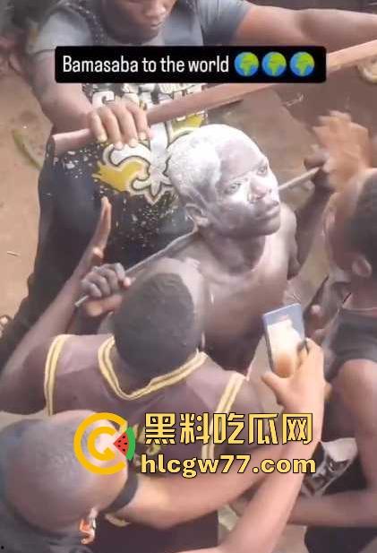 非洲部落割包皮 这也太生猛了吧 包皮一拉一刀下去直接割掉 这老哥全程面无表情！-6