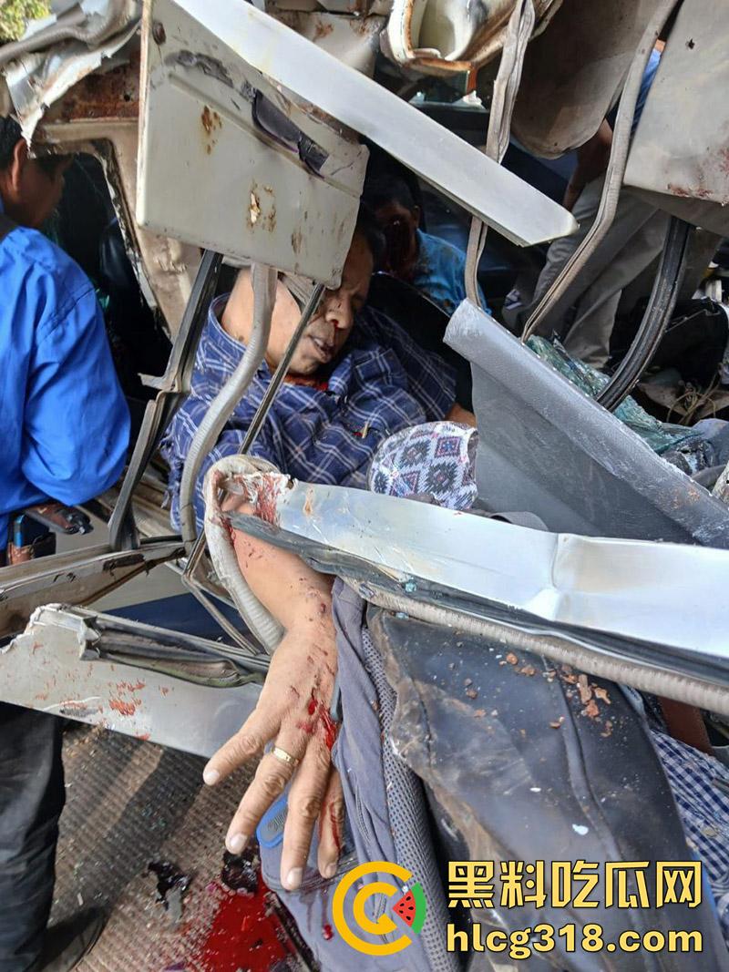 车祸没死脸却没了！印尼发生惨烈车祸，超速行驶失控撞上货车，乘客全部死亡司机面目全非！-6