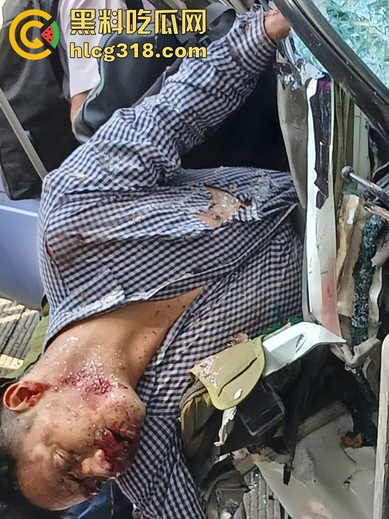 车祸没死脸却没了！印尼发生惨烈车祸，超速行驶失控撞上货车，乘客全部死亡司机面目全非！-7