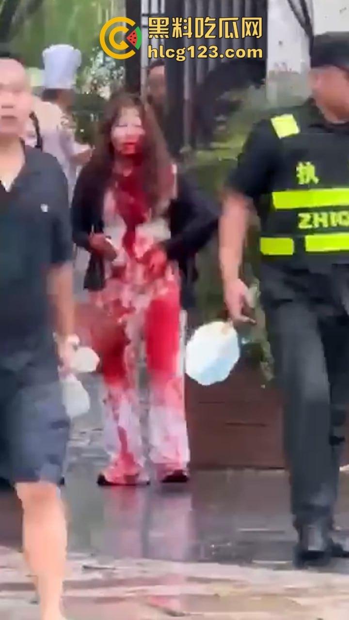 当街放血！姑苏花季学妹小红书约拍六旬老头 因不满出片效果遭对方水果刀伺候 当场昏迷-8