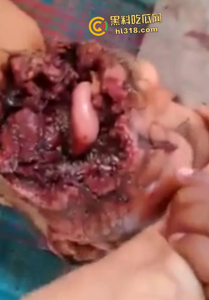 埃及老人惨遭机器重击，脸烂成浆五官全毁，只能阿巴阿巴发声音，不能说话，估计过几天就要长蛆了！-2