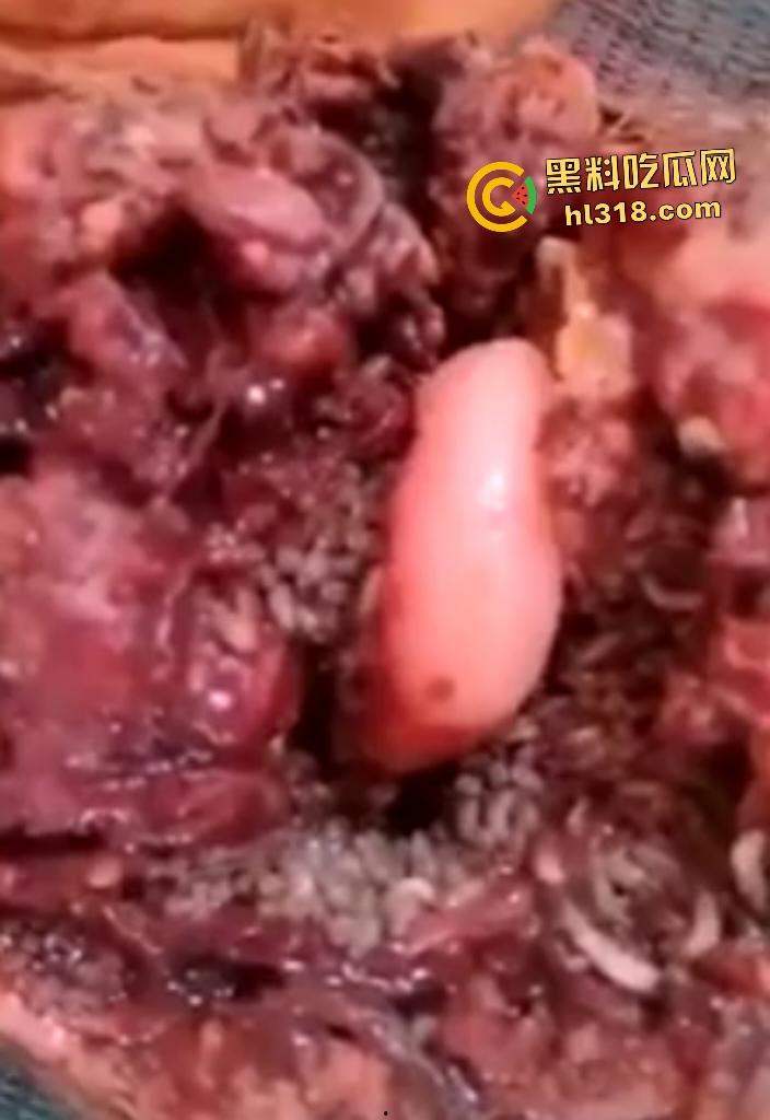 埃及老人惨遭机器重击，脸烂成浆五官全毁，只能阿巴阿巴发声音，不能说话，估计过几天就要长蛆了！-5