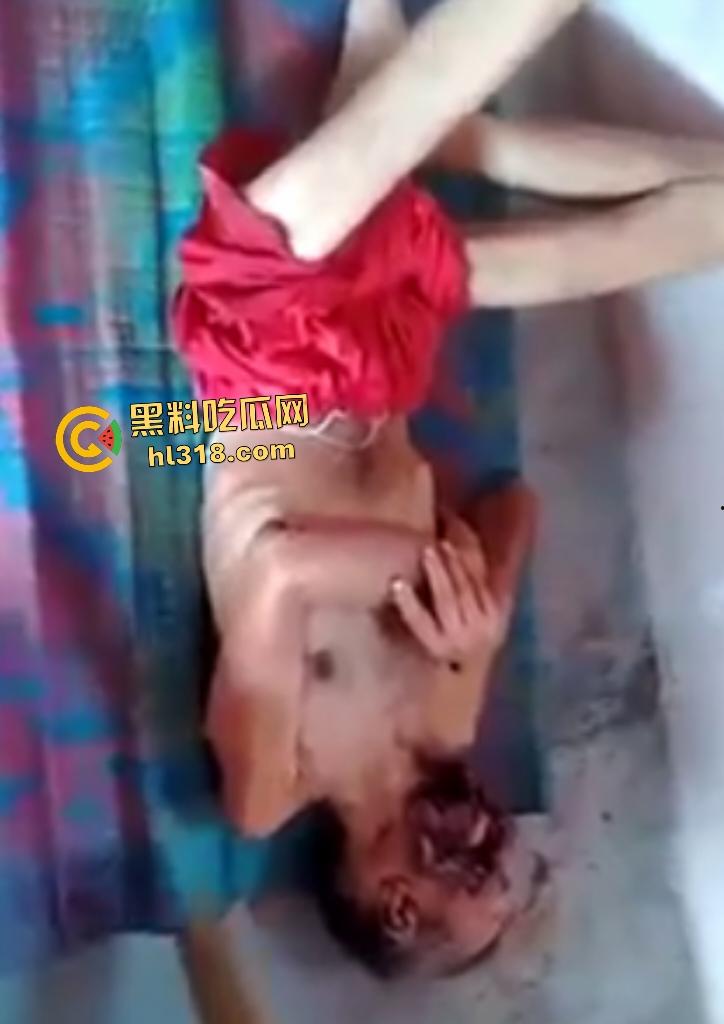 埃及老人惨遭机器重击，脸烂成浆五官全毁，只能阿巴阿巴发声音，不能说话，估计过几天就要长蛆了！-6