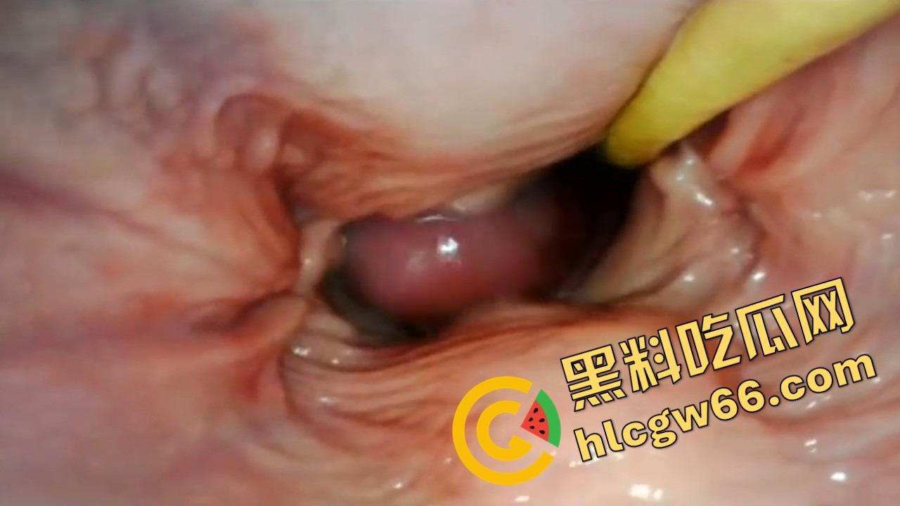 欧美巨屌狂插内窥视角爆火阴道深处褶皱翻卷、肉壁收缩蠕动，全程高清记录快感源头！-9