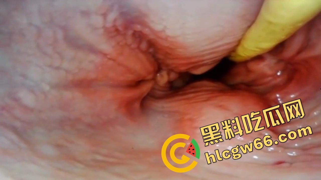 欧美巨屌狂插内窥视角爆火阴道深处褶皱翻卷、肉壁收缩蠕动，全程高清记录快感源头！-11