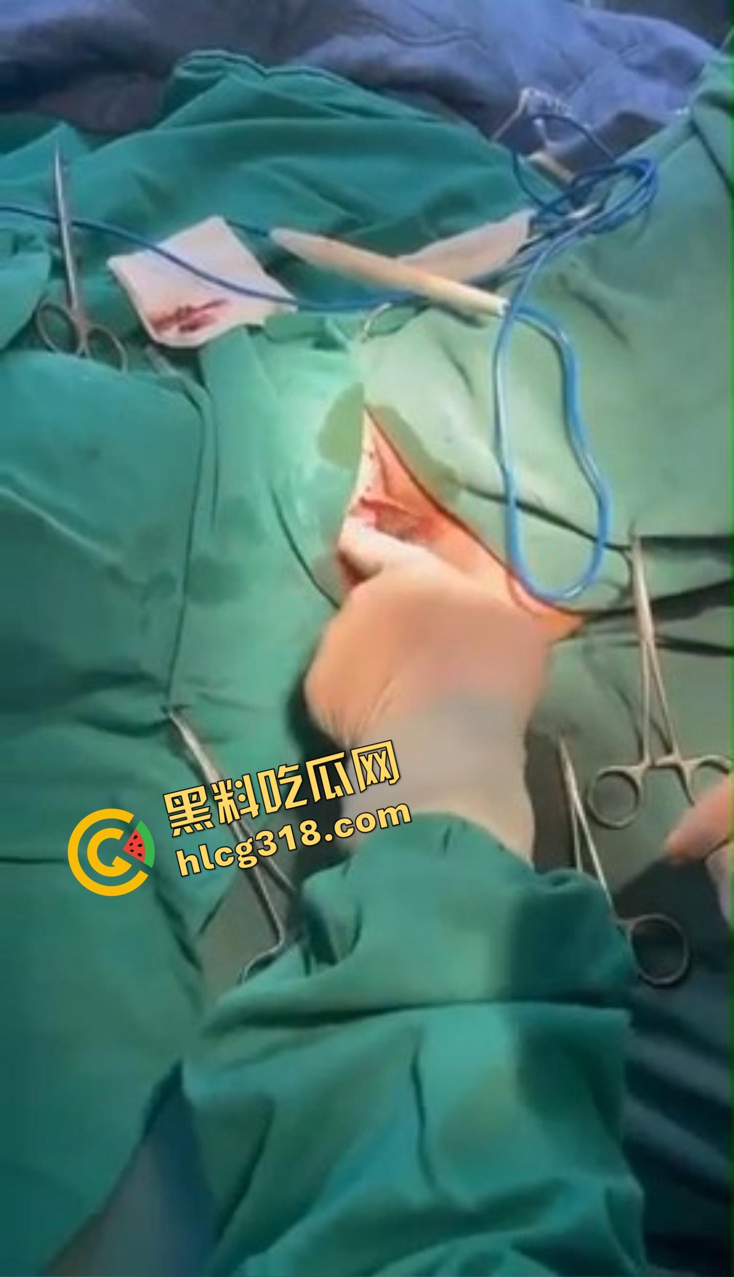 你还以为高端外围豪车天生紧？全靠阴道收缩术收成死夹货，富哥上手就说一根手指进去都得抹油！-8