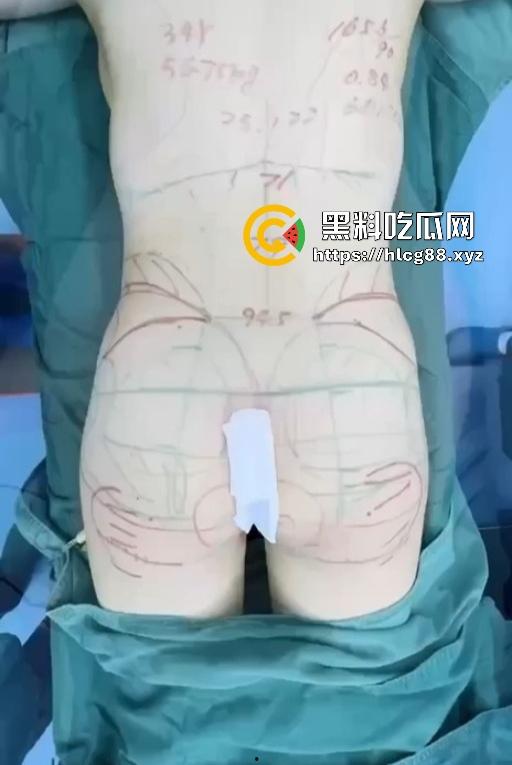 现在妹子为美疯魔抽脂隆奶塞逼艾灸，骚穴子宫烤得喷香，医美变态到艾灸鸡巴都出现了！-11