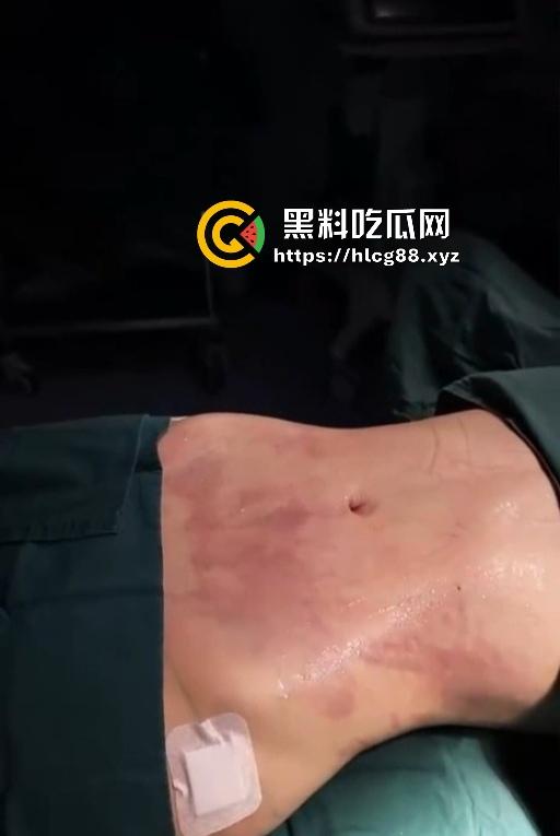 现在妹子为美疯魔抽脂隆奶塞逼艾灸，骚穴子宫烤得喷香，医美变态到艾灸鸡巴都出现了！-12