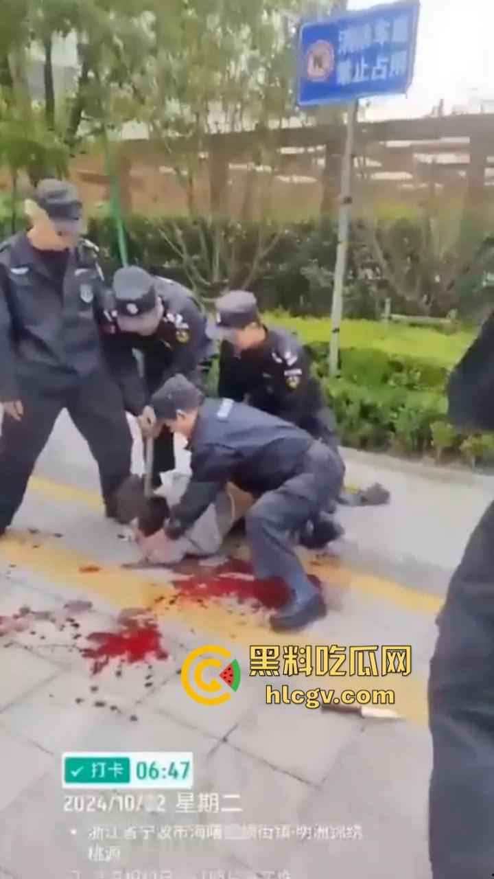 宁波海曙区一女子送孩子上学路上被人追砍 孩子的身受数刀 视频直击血腥现场-10