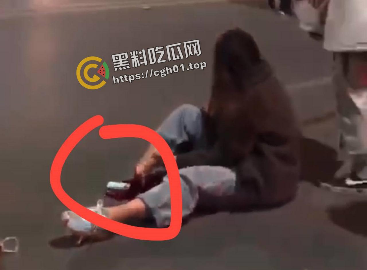 摩托车女骑士装上大货车 小腿直接断掉 现场血腥画面流出-2