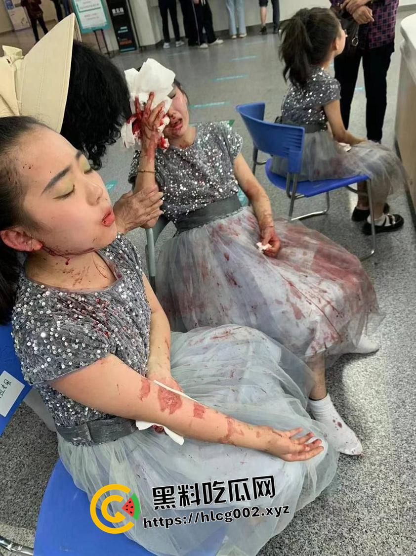 江苏南通渣土车撞翻装满春游学生的校车  死伤无数 一地尸体碎片 现场血腥视频流出-2