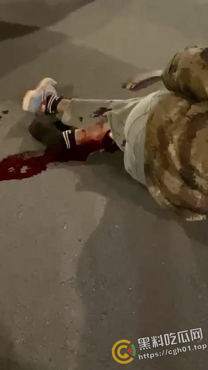 桂林野仔半夜飙车 把路人小腿撞断后没钱赔 有钱买鬼火 没钱擦屁股 现场血腥视频流出-2