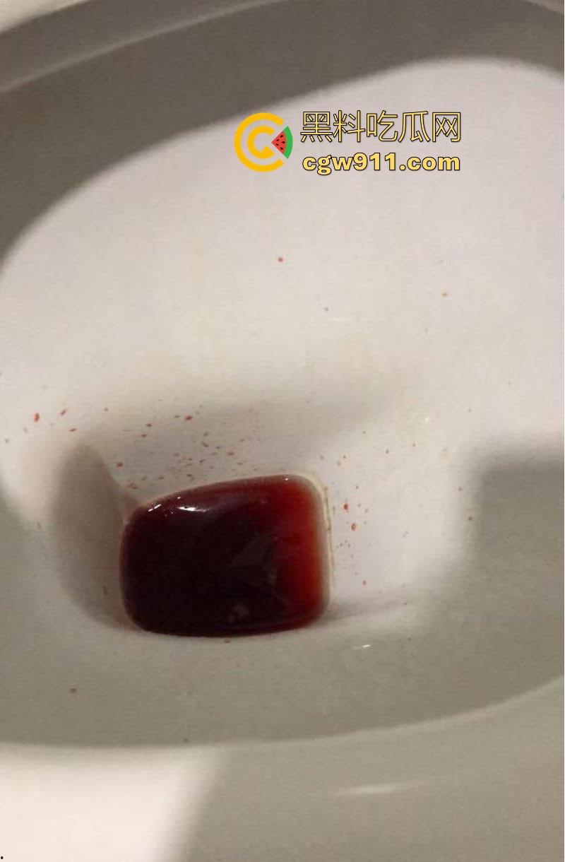 瓜友国庆节撸管翻车，撸到虚脱、心悸、血压飙升，把自己撸进ICU，聊天记录全爆疯狂自述，瓜友们要节制啊！-10