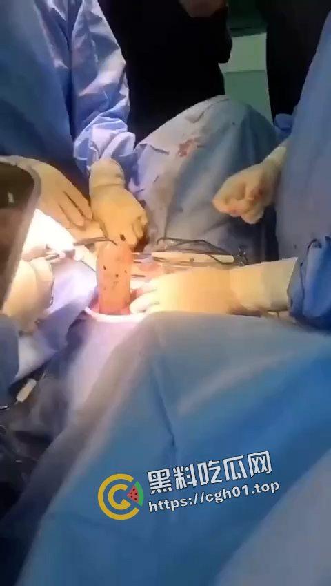 活久见!超大假阳具塞进体内拿不出来只能做手术 你们男同玩的都这么狠吗-2