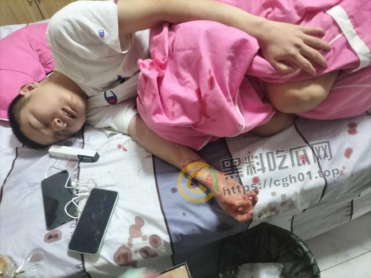 蚌埠大学生为参军做飞秒手术 在部队内遭感染被丢回家 最终不治身亡 家人抖音喊冤被封-9