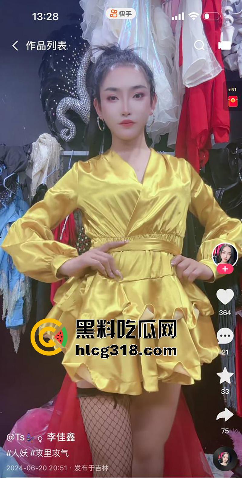 吉林顶级ts尤物【李佳鑫】，高颜值细腰长腿骚货，经常夜场演出穿着诱人，约炮大哥爆操菊花！-3