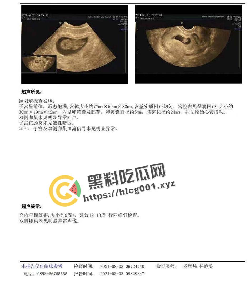 临高网红【邓良娟】手机遭破解泄密 偷吃怀孕打胎三次还骗男友钱 最后接盘侠全盘接下 私密视频流出-6