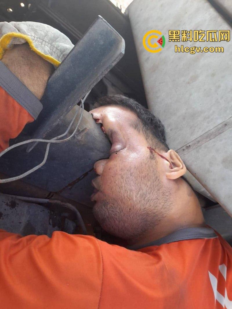 太惨了!因操作不当 巴西倒霉男子脑袋被挤爆 血腥现场视频曝光 胆小慎入-5