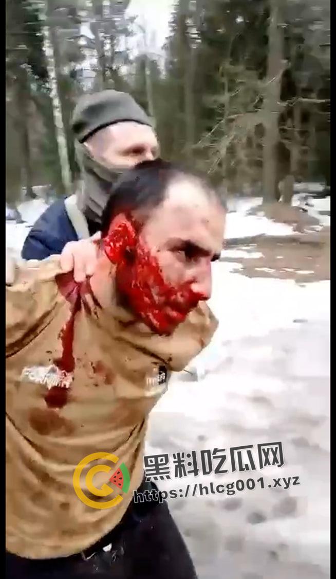 俄罗斯音乐厅恐怖袭击 恐怖分子放出第一视角 枪杀完还要补刀 以及被抓住后处决现场 血腥慎点！-4