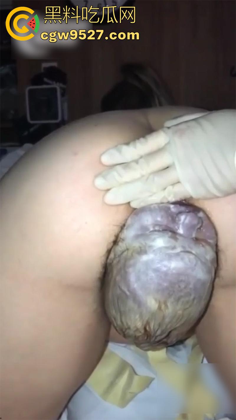 孕妇接生现场画面，体验生孩子的全过程，幸亏是个大肥逼，不然一定痛死了，原来大家都是这么来的啊！-4
