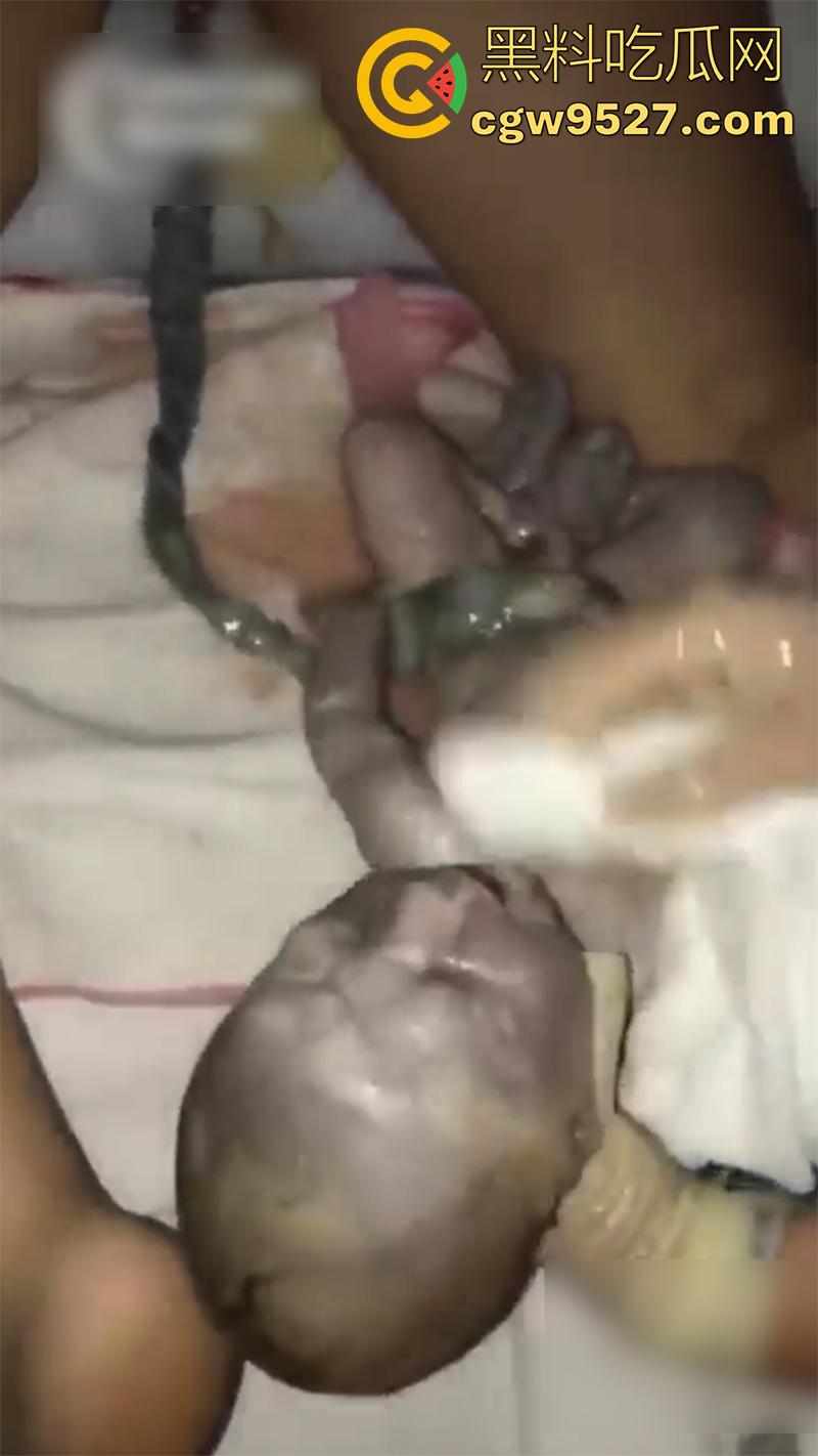 孕妇接生现场画面，体验生孩子的全过程，幸亏是个大肥逼，不然一定痛死了，原来大家都是这么来的啊！-8