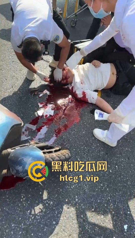 外卖小哥摩托车撞倒女子，女子头破血流浑身抽搐！-1