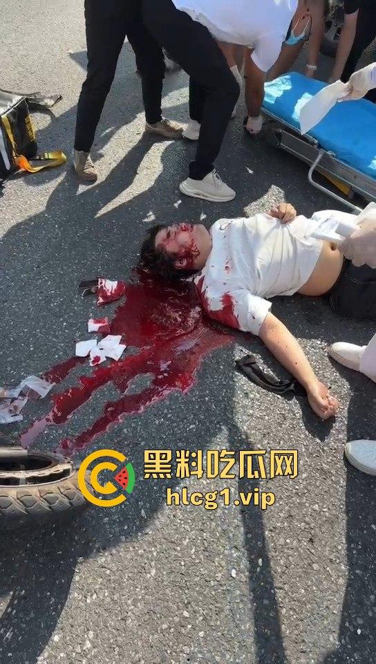 外卖小哥摩托车撞倒女子，女子头破血流浑身抽搐！-3