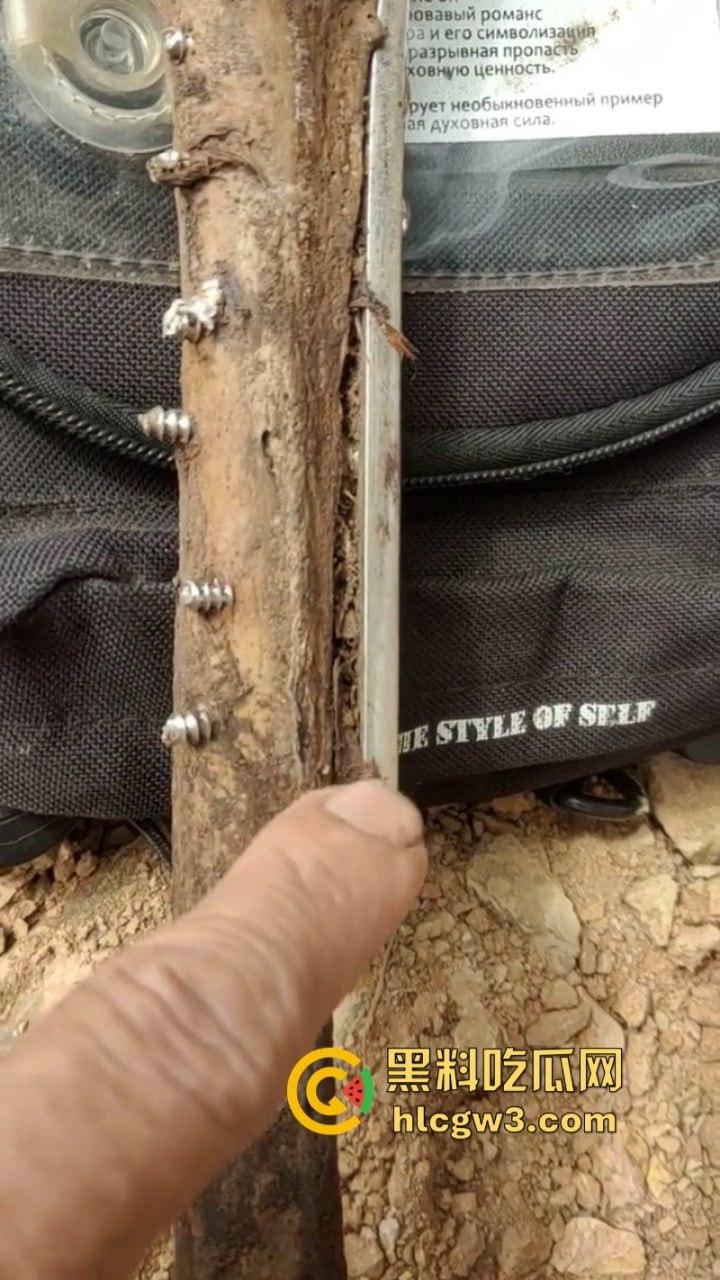 大妈去世后尸骨爆出惊人秘密 广西玉林大化骨科医院恐怖接骨手术让人震惊-6