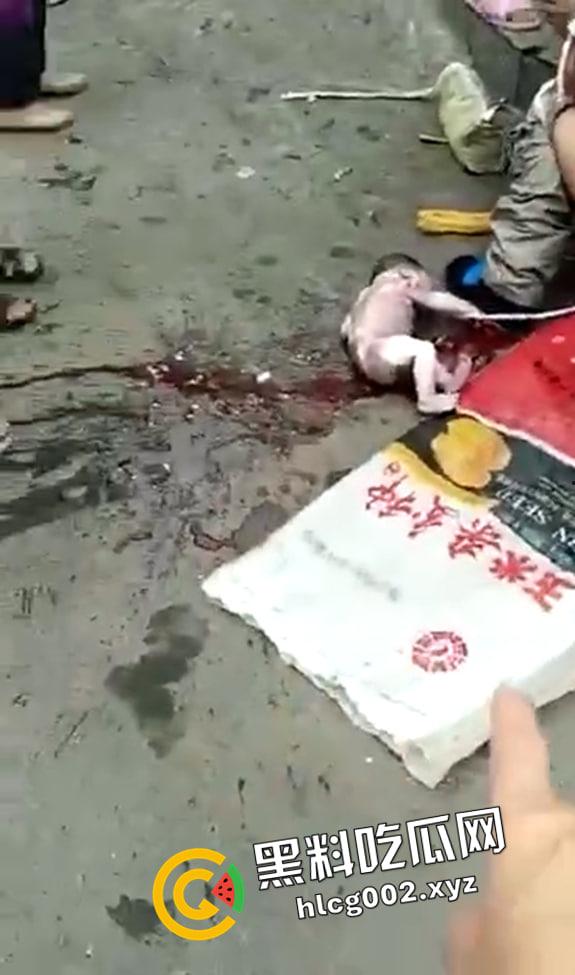 妇女当街站着生小孩 直接就拉出来了 现场视频流出 血腥慎入-3