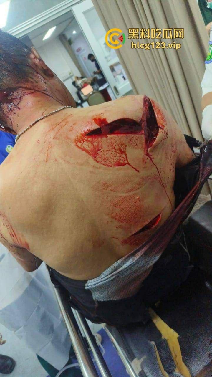 大型皮开肉绽现场！印尼一地发生冲突 有内战的国家真的不要去！-13