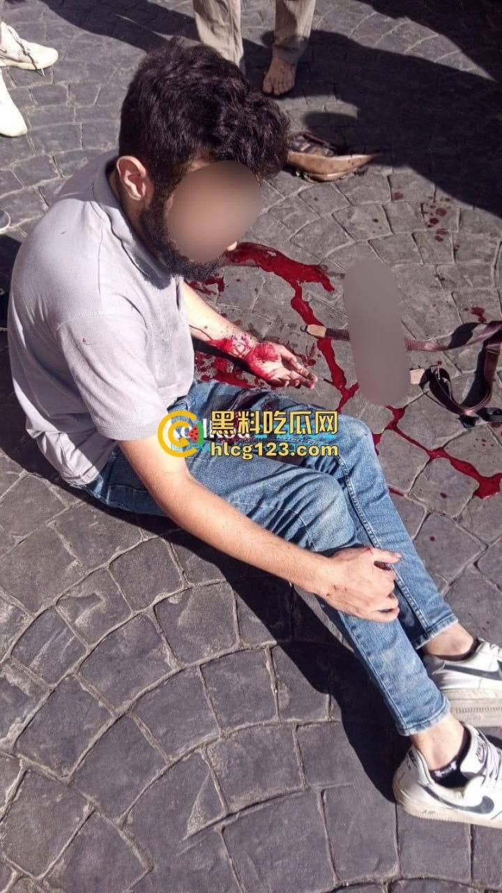 黎巴嫩发生大规模BP机爆炸事件 4000多人受伤 11人死亡 以色列远程植爆-6