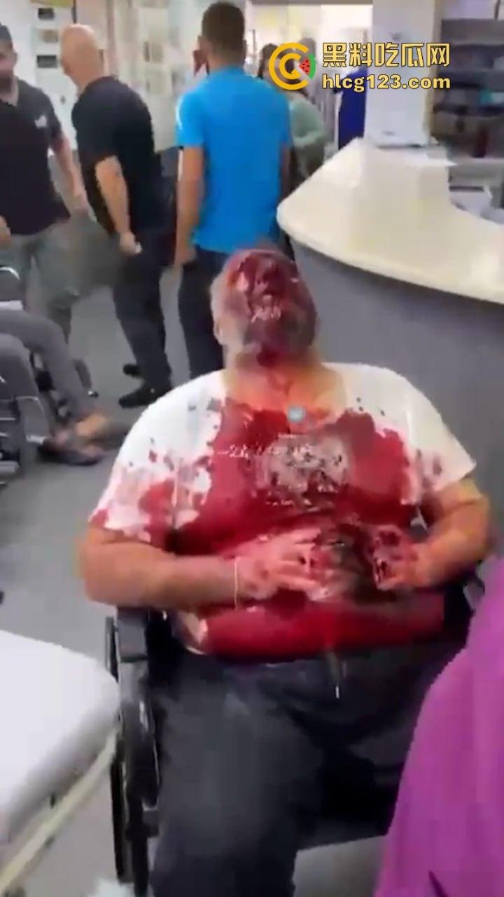 黎巴嫩发生大规模BP机爆炸事件 4000多人受伤 11人死亡 以色列远程植爆-9