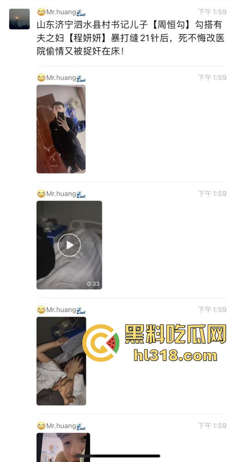 山东济宁泗水县书记儿子【周恒勾】，勾搭撩骚有夫之妇【程妍妍】，被夫家暴打缝21针，竟再次医院偷情 ！-1