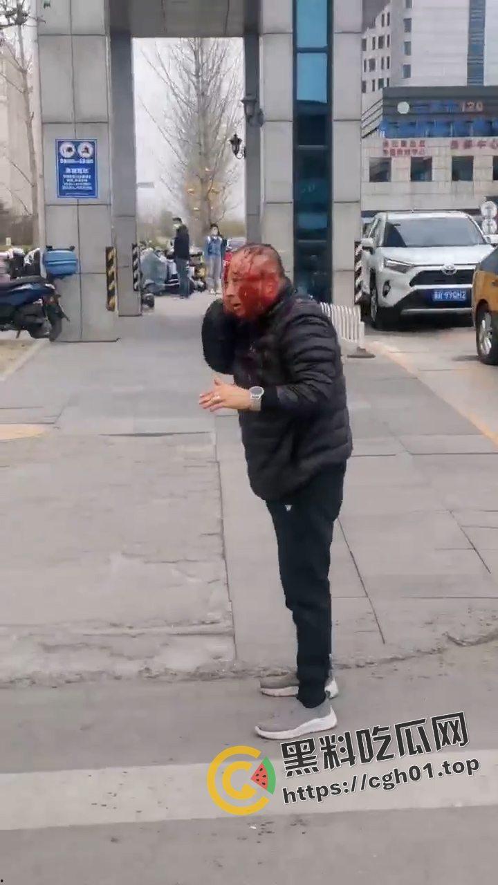 河北燕郊滴滴大战出租车!因为15元得单子出租车司机拿螺丝刀把滴滴司机脑袋捅烂 现场血腥画面流出-6