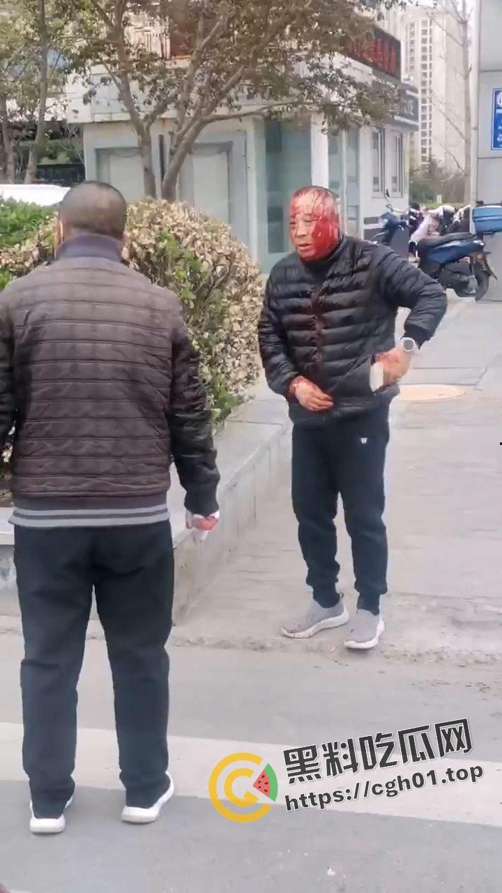 河北燕郊滴滴大战出租车!因为15元得单子出租车司机拿螺丝刀把滴滴司机脑袋捅烂 现场血腥画面流出-7