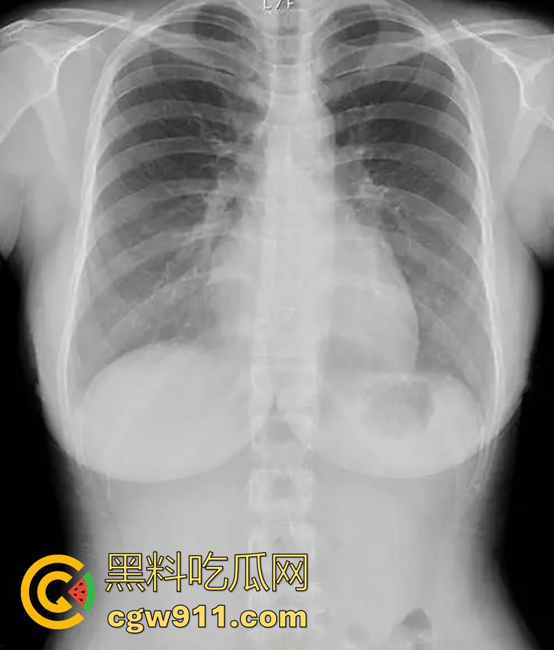 湾湾成人展来啦！现场拍摄新进女优【天木纯】，颜值可爱巨乳傲人，展示CT片自证美乳真实，天然大奶的确奶味十足！-2