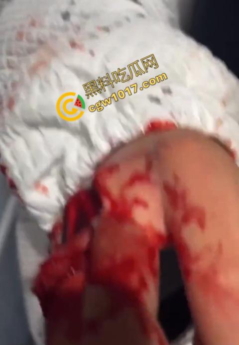 血腥慎点！社会混混残忍虐打小伙，马桶刷戳脸，铁管刺手，手背戳破血肉模糊，骨头暴露，惨不忍睹，令人心寒！-9