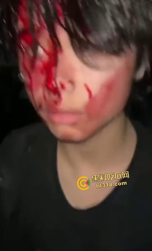 江西万载霸凌者反被群殴血溅当场！黄毛黑毛被打出心理阴影，棍子爆头血流不止，全靠路人打120急救！-8