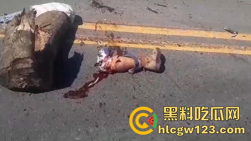 血腥恐怖交通事故，圣克鲁斯男骑手出车祸，左腿被当场撞断，现场视频流出胆小者勿入！-4