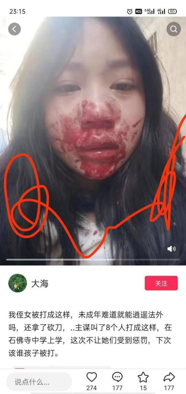 湖北 武穴 女生 被 围殴 霸凌 打人 砍刀威胁 事件-3