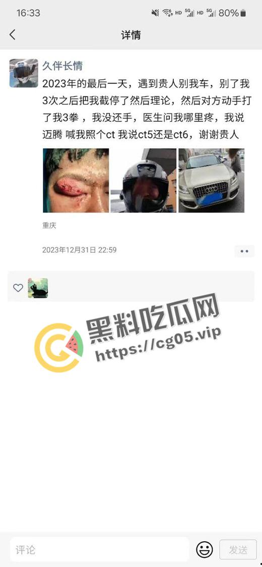 新年遇贵人！重庆渝中摩托佬莫名其妙被奥迪别车三次还挨打 事后律师表示不会少于五万 挨打挨出来一辆新摩托-1